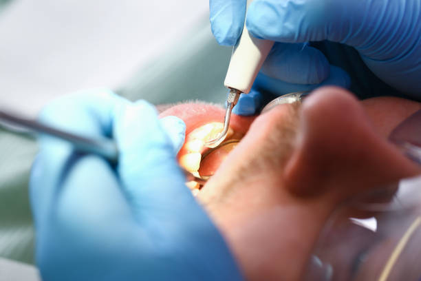 Best Emergency Dental Services for Seniors in Buena Vista, MI