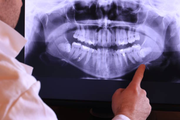 Best Emergency Dental Care for Abscessed Tooth in Buena Vista, MI