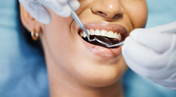 Best Broken or Cracked Tooth Emergency Dentist in Buena Vista, MI