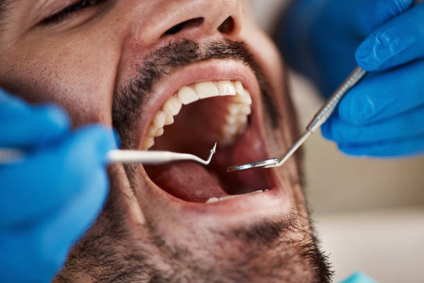 Best Emergency Dental Extractions in Buena Vista, MI